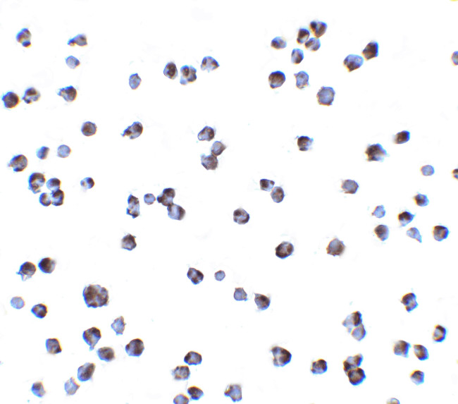 IKK alpha Antibody in Immunocytochemistry (ICC/IF)