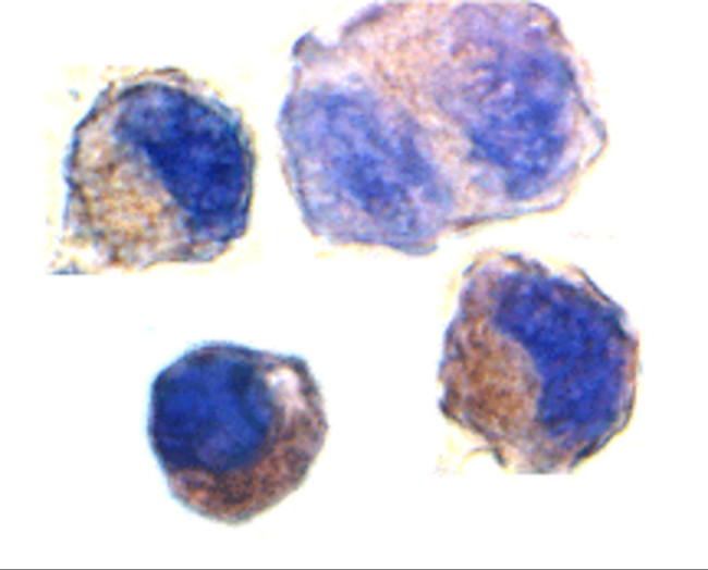 ADAM10 Antibody in Immunocytochemistry (ICC/IF)