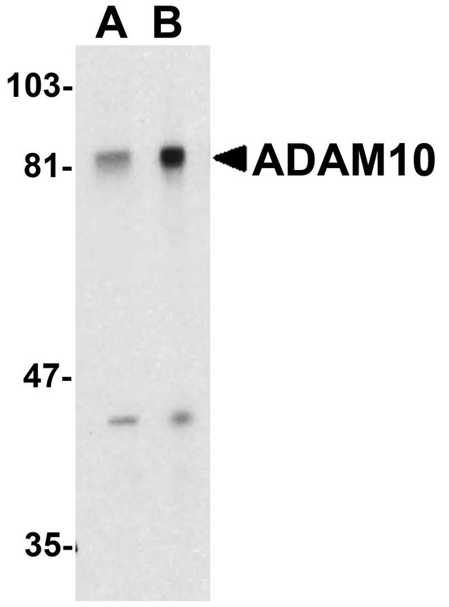 ADAM10 Antibody in Western Blot (WB)