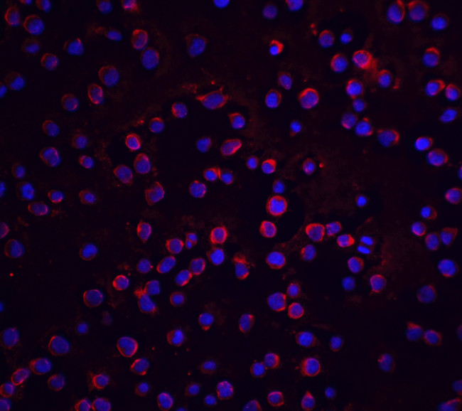 FLIP Antibody in Immunocytochemistry (ICC/IF)