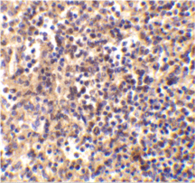 DNase II Antibody in Immunohistochemistry (IHC)