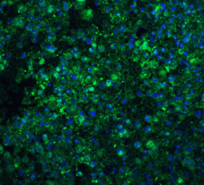 CIDEA Antibody in Immunohistochemistry (IHC)