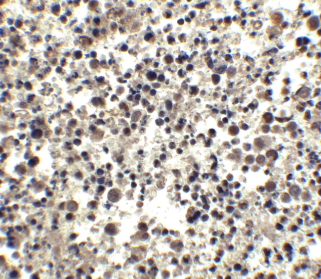 CIDEA Antibody in Immunohistochemistry (IHC)