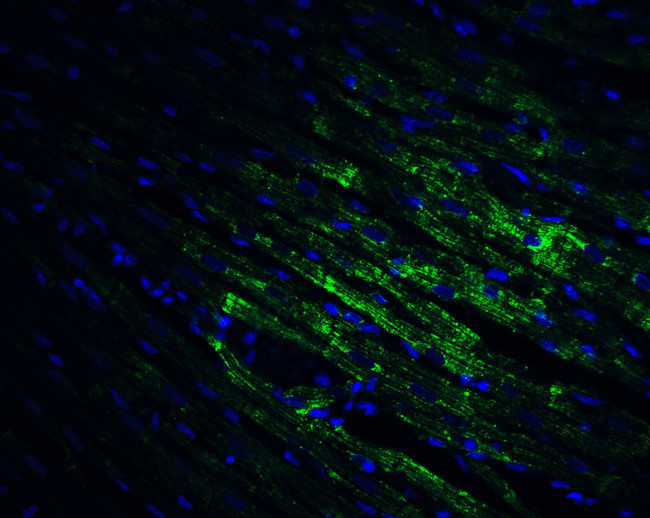 CX3CR1 Antibody in Immunohistochemistry (PFA fixed) (IHC (PFA))