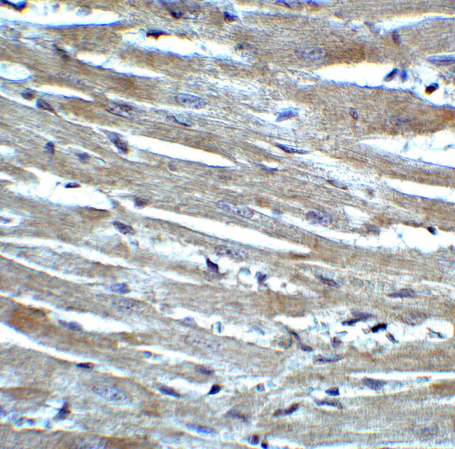 CX3CR1 Antibody in Immunohistochemistry (Paraffin) (IHC (P))