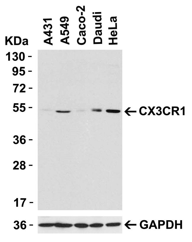 CX3CR1 Antibody in Western Blot (WB)