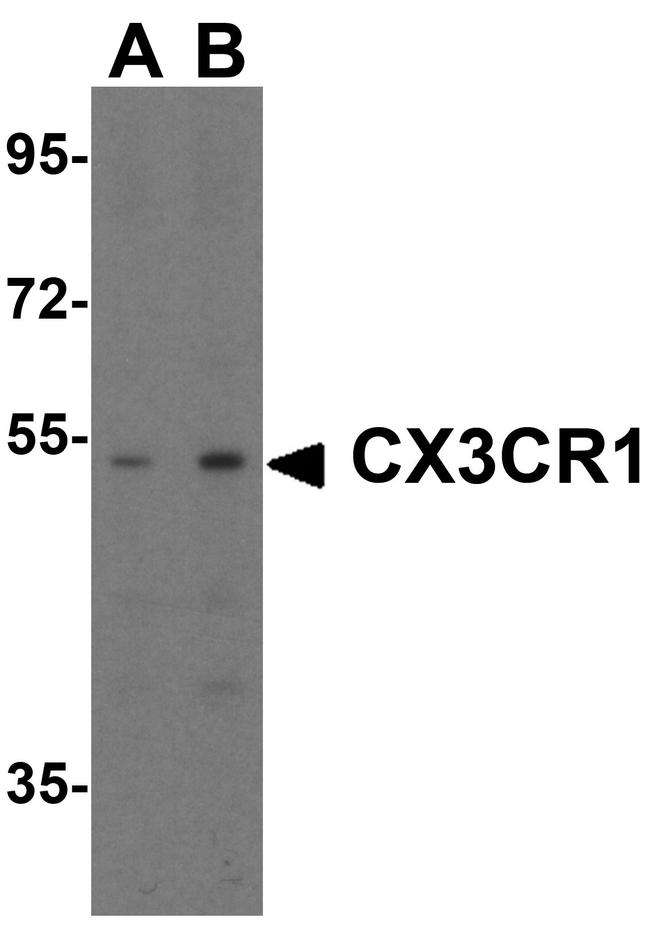 CX3CR1 Antibody in Western Blot (WB)