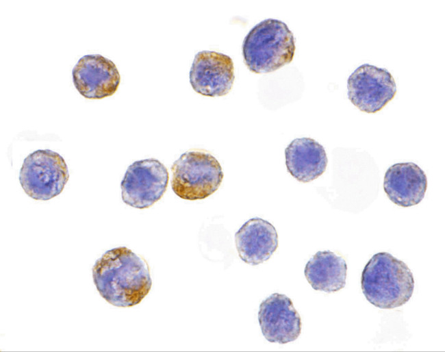 IKK alpha Antibody in Immunocytochemistry (ICC/IF)