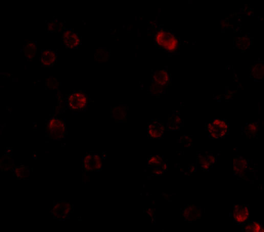 IKK alpha Antibody in Immunocytochemistry (ICC/IF)