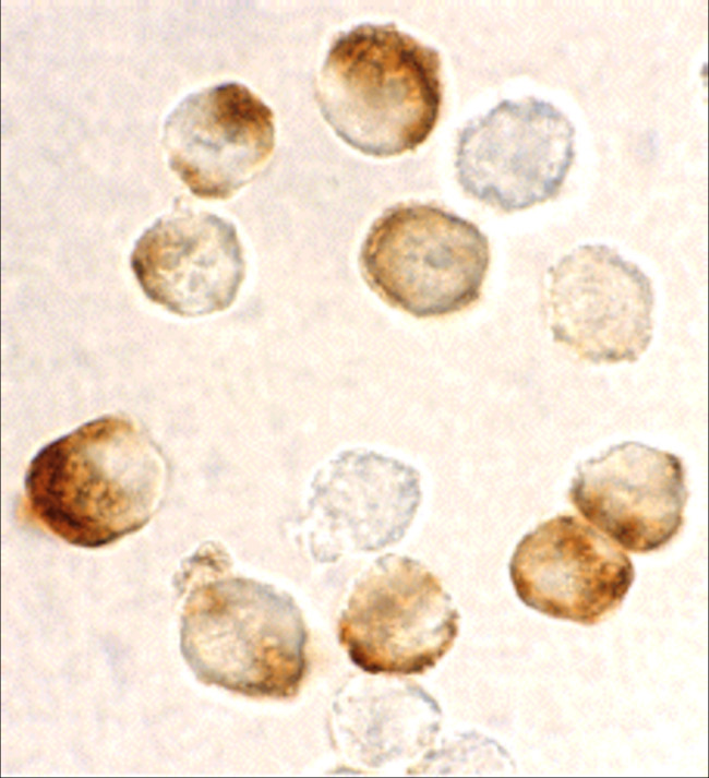 IKK beta Antibody in Immunocytochemistry (ICC/IF)