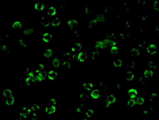 IKK beta Antibody in Immunocytochemistry (ICC/IF)