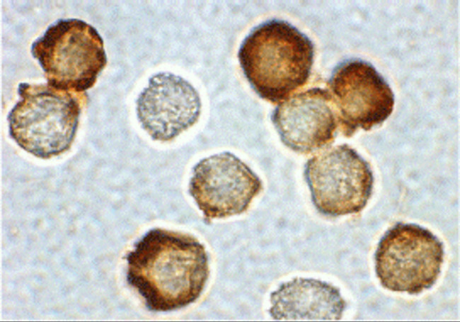 IRAK2 Antibody in Immunocytochemistry (ICC/IF)