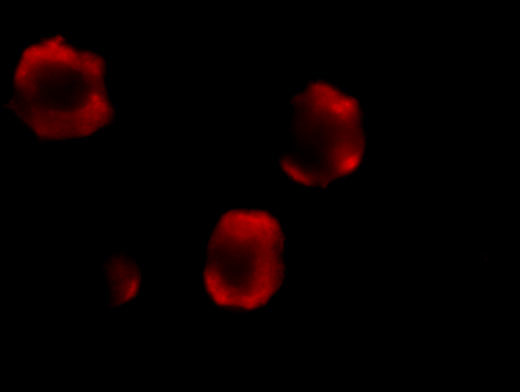 IRAK2 Antibody in Immunocytochemistry (ICC/IF)