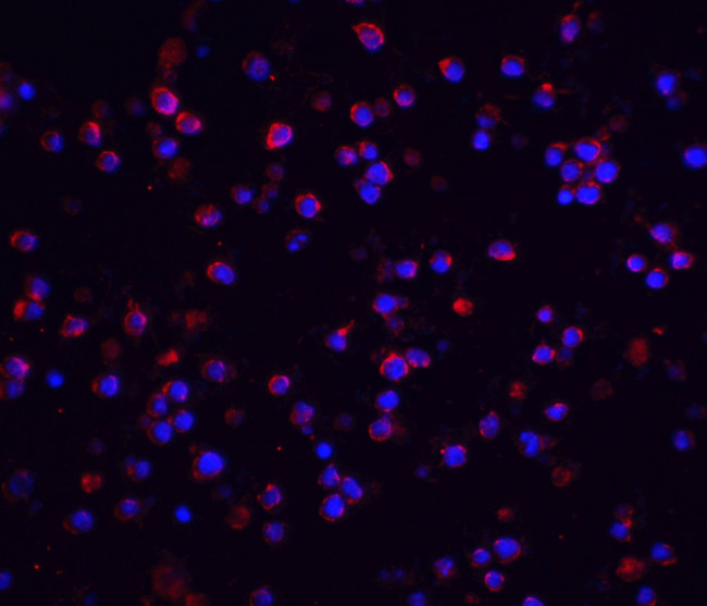 IRAK2 Antibody in Immunohistochemistry (IHC)