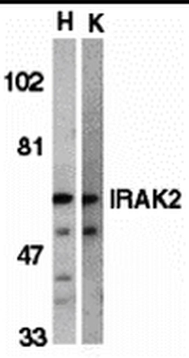 IRAK2 Antibody in Western Blot (WB)