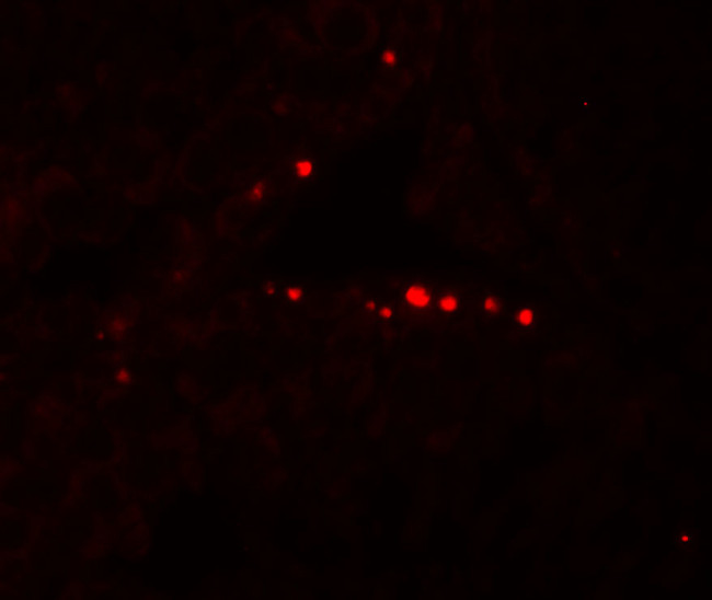 MyD88 Antibody in Immunohistochemistry (Paraffin) (IHC (P))