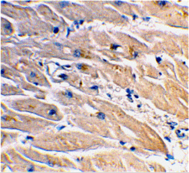 MyD88 Antibody in Immunohistochemistry (Paraffin) (IHC (P))