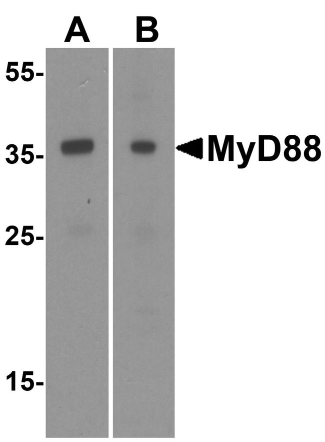 MyD88 Antibody in Western Blot (WB)