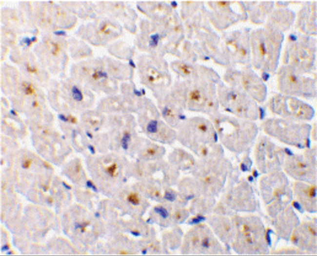 DcR3 Antibody in Immunohistochemistry (IHC)