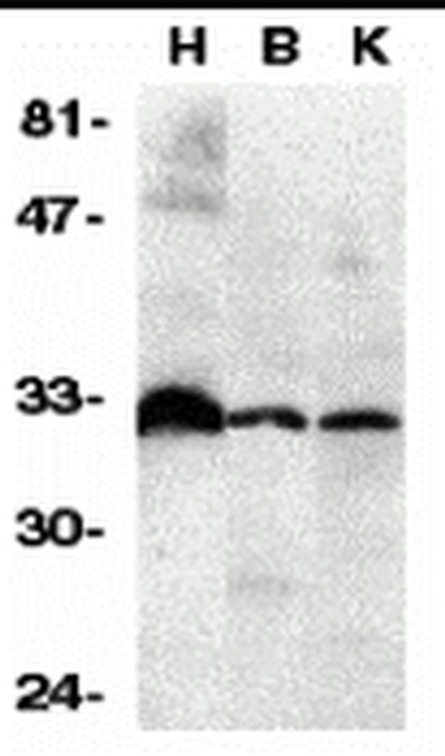 DcR3 Antibody in Western Blot (WB)