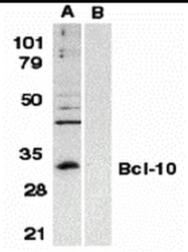 Bcl-10 Antibody in Western Blot (WB)