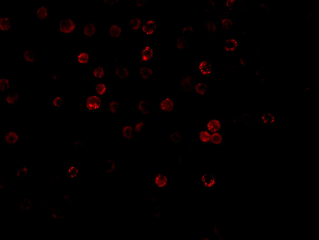 CD263 (TRAIL-R3) Antibody in Immunocytochemistry (ICC/IF)