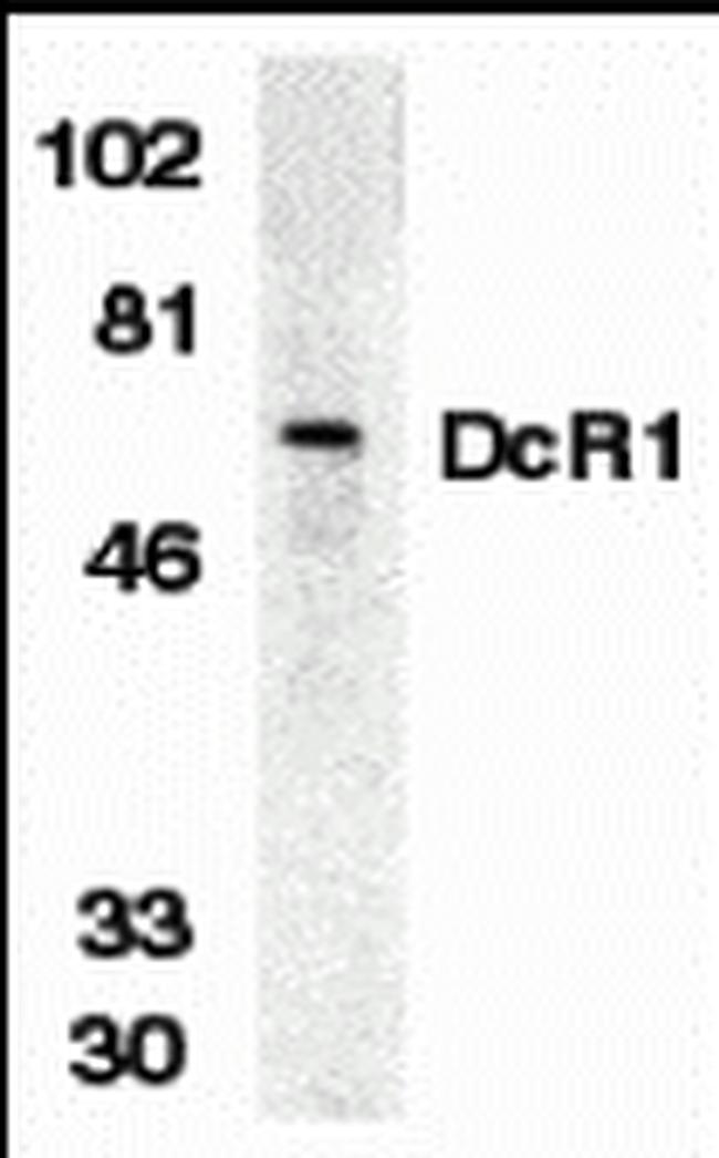 CD263 (TRAIL-R3) Antibody in Western Blot (WB)