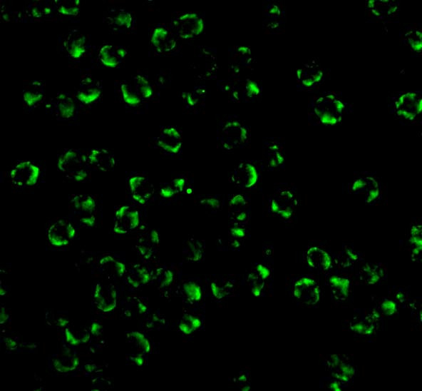 RIP2 Antibody in Immunocytochemistry (ICC/IF)