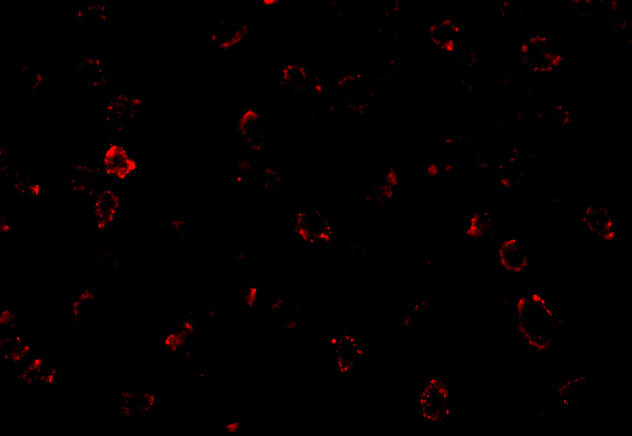 CX3CR1 Antibody in Immunocytochemistry (ICC/IF)