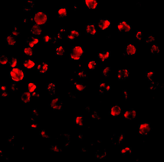 IRAK2 Antibody in Immunocytochemistry (ICC/IF)