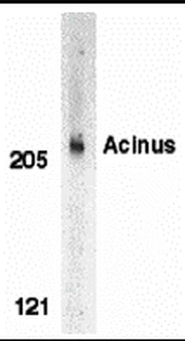 Acinus Antibody in Western Blot (WB)