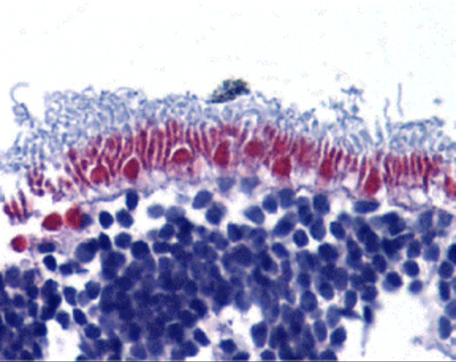 AIF Antibody in Immunohistochemistry (Paraffin) (IHC (P))