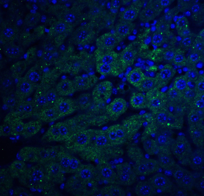 F1A alpha Antibody in Immunohistochemistry (IHC)