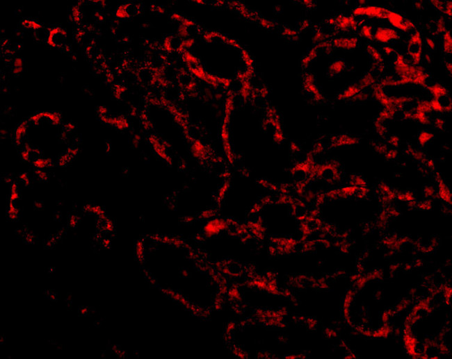 RIP3 Antibody in Immunohistochemistry (Paraffin) (IHC (P))