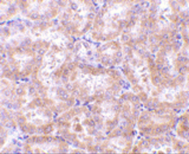 RIP3 Antibody in Immunohistochemistry (Paraffin) (IHC (P))