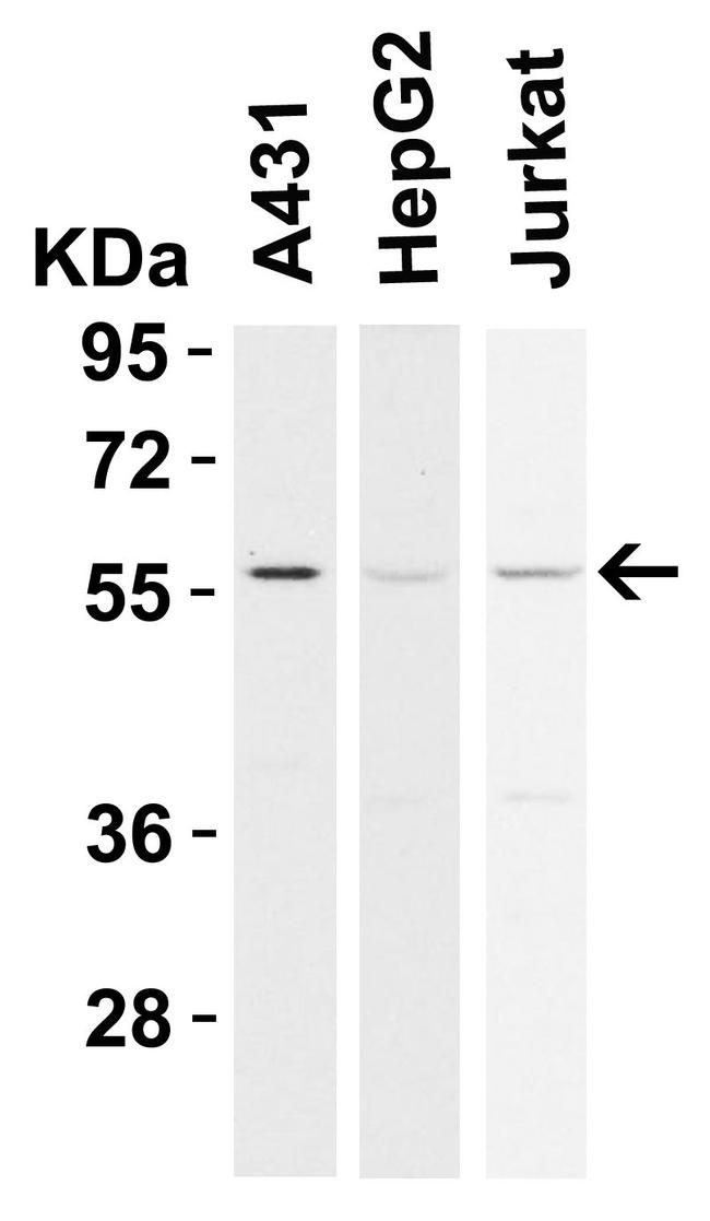 RIP3 Antibody in Western Blot (WB)