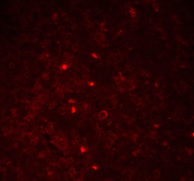 PYCARD Antibody in Immunohistochemistry (Paraffin) (IHC (P))