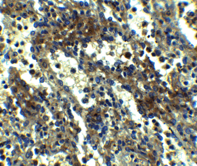 PYCARD Antibody in Immunohistochemistry (Paraffin) (IHC (P))