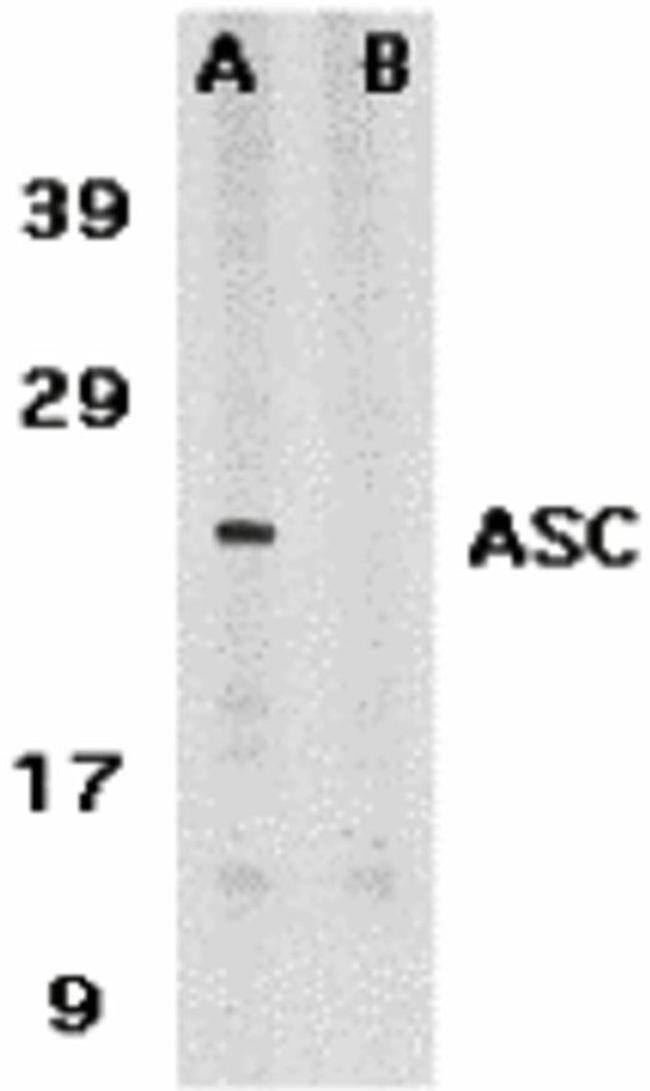 PYCARD Antibody in Western Blot (WB)