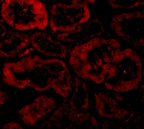 BNIP3L Antibody in Immunohistochemistry (IHC)