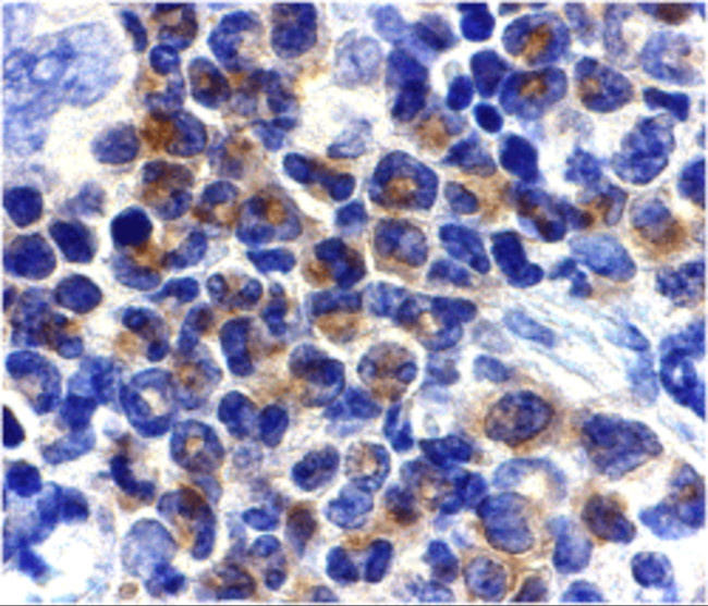 DAPK2 Antibody in Immunohistochemistry (IHC)