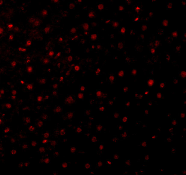 Caspase 12 Antibody in Immunocytochemistry (ICC/IF)