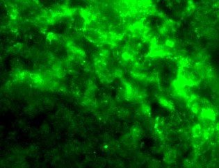 DC-SIGN Antibody in Immunohistochemistry (IHC)