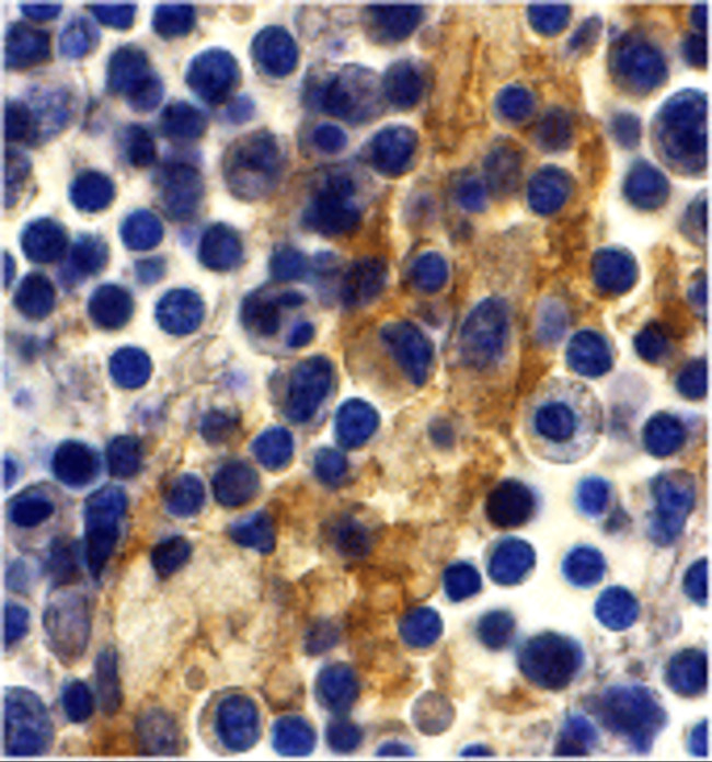 DC-SIGN Antibody in Immunohistochemistry (IHC)