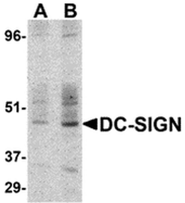 DC-SIGN Antibody in Western Blot (WB)