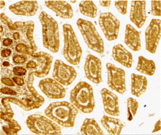 DC-SIGN Antibody in Immunohistochemistry (IHC)