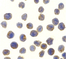 TBK1 Antibody in Immunocytochemistry (ICC/IF)