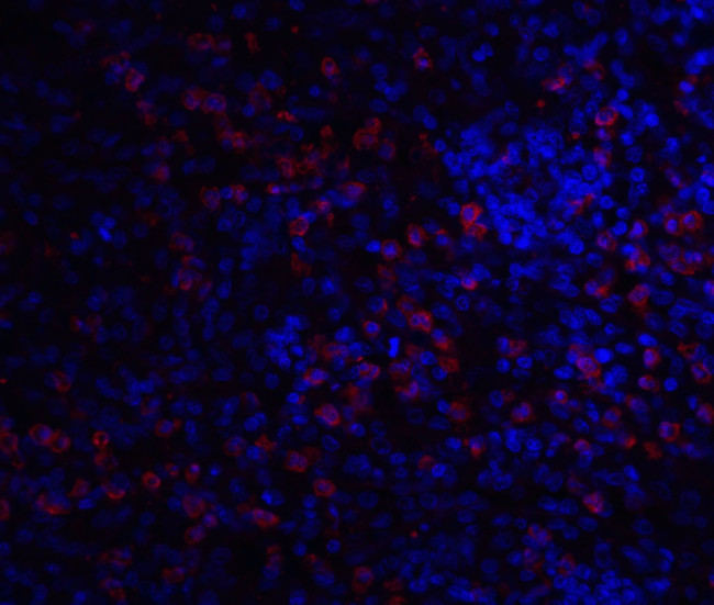 IRAK-M Antibody in Immunocytochemistry (ICC/IF)