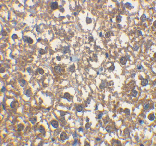 IRAK-M Antibody in Immunohistochemistry (IHC)