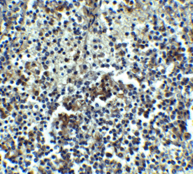 IRAK-M Antibody in Immunohistochemistry (IHC)